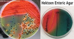 <p>Hektoen enteric agar (HE) -<span>orange/ yellow colonies and agar</span></p>