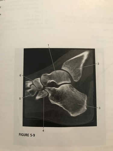 <p>Number 6 in the figure corresponds to which of the following?</p><p>A) navicular </p><p>B) cuboid</p><p>C) calcaneus </p><p>D) talus </p>