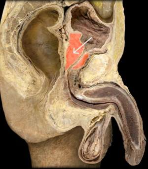 <p>identify the structured highlighted?</p>