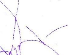 <p>What is the shape and arrangement of these bacterial cells?</p><p> </p><p>streptobacilli</p><p> </p><p>staphylobacilli</p><p> </p><p>coccobacilli</p><p> </p><p>a palisade arrangement</p>