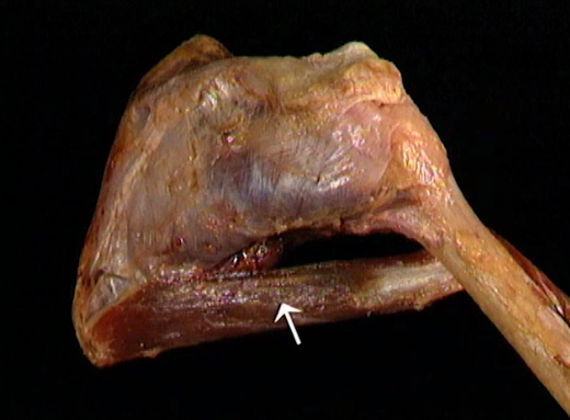 <p>Oppervlakkig, schouder</p>