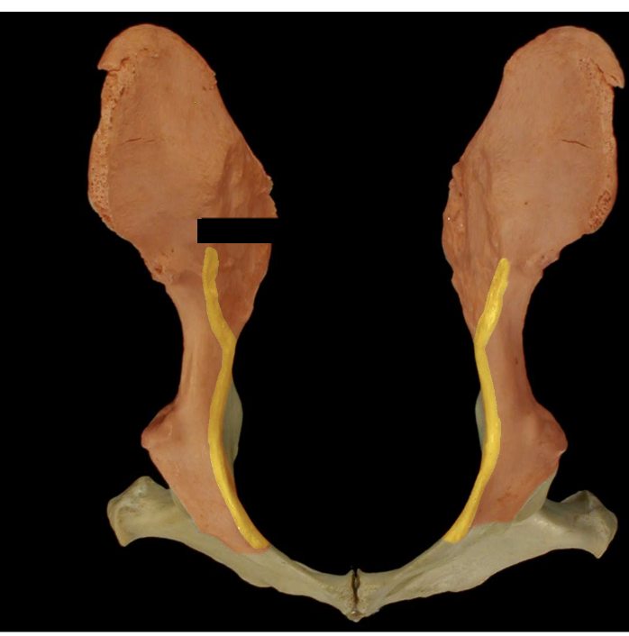 <p>Arcuate line of the Ilium </p>