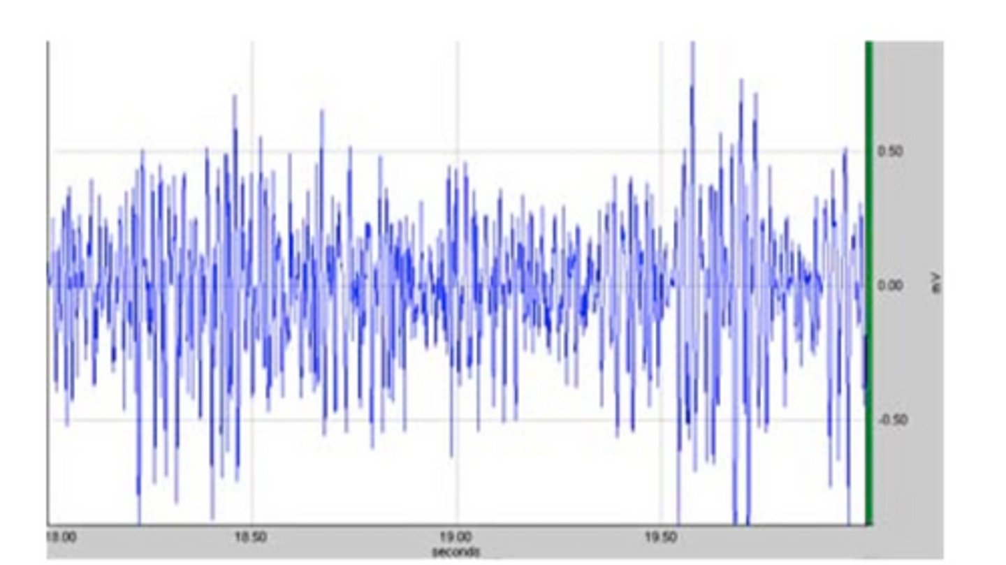 <p>name this recording</p>