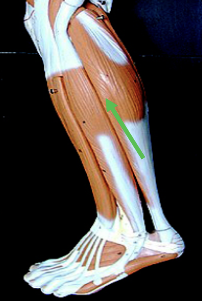 <p>Identify the muscle indicated by the pointer.</p>