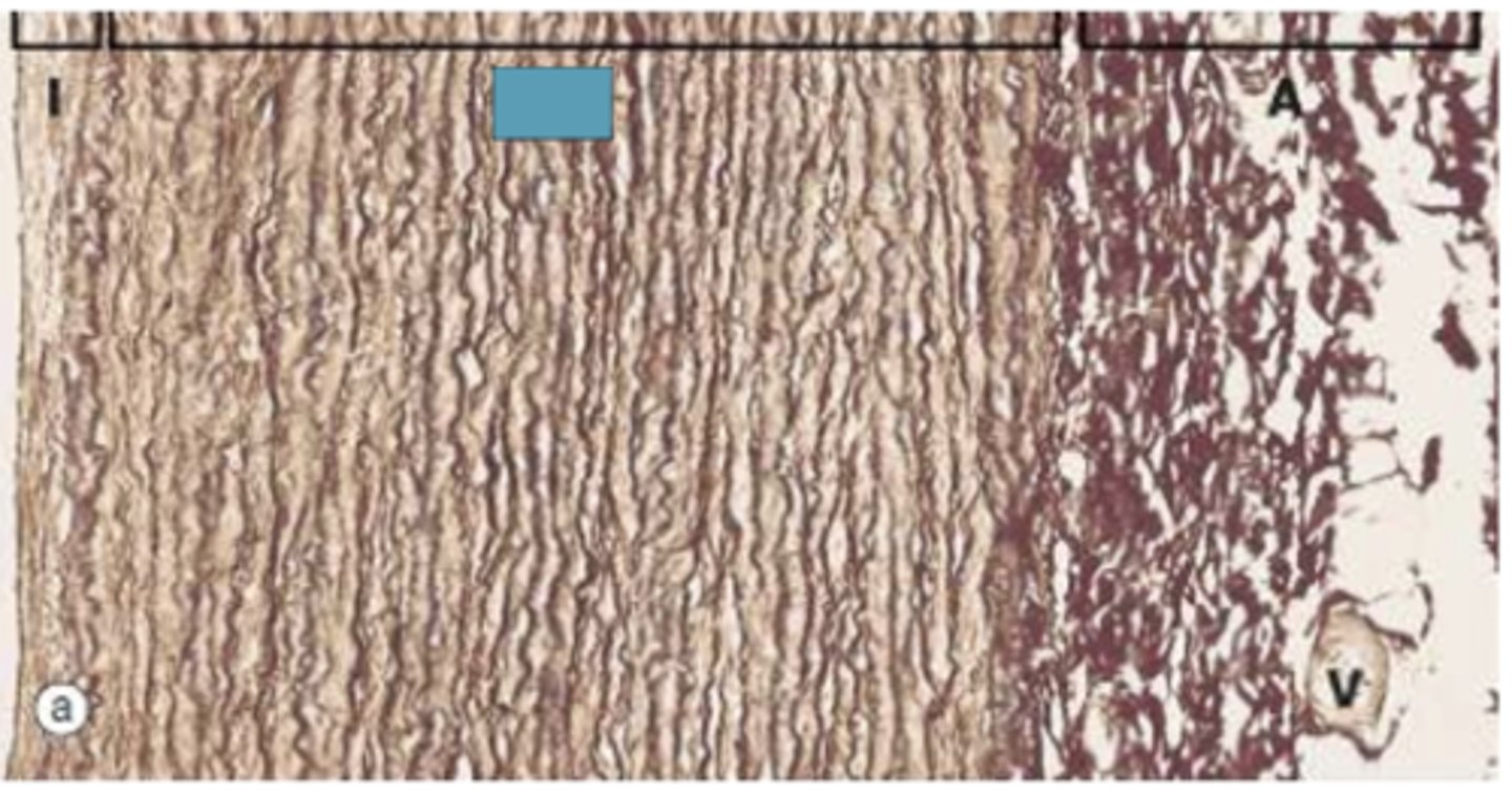 <p>Identify the layer of the vessel</p>