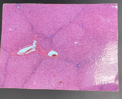 <p>Pancreas</p><ul><li><p>Acini</p></li><li><p>Islets of Langerhans or pancreatic islets</p></li></ul><p>Liver</p><ul><li><p>Lobules</p></li></ul><p></p>