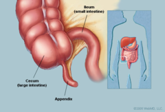 <p>vestigial; appendicitis</p>