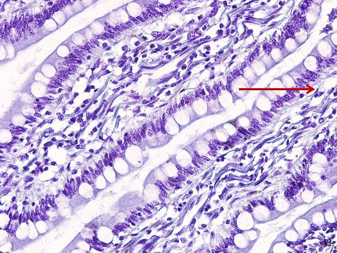 <p>Tế bào gì ?</p>