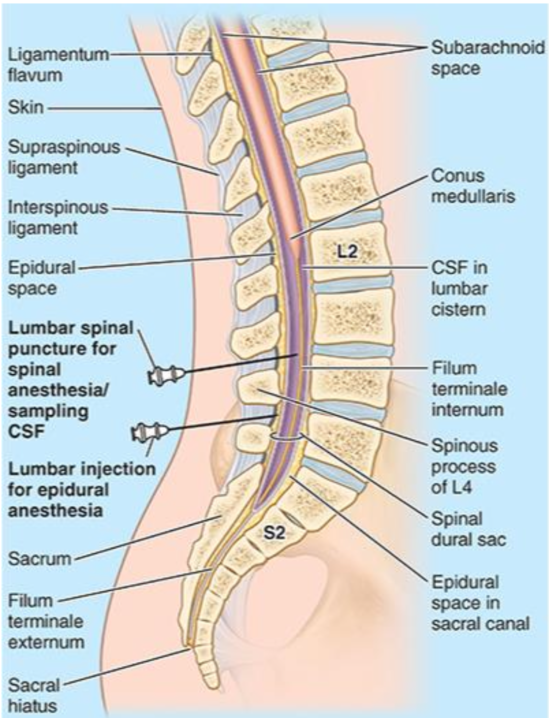 <p>Skin, subcutaneous tissue, supraspinous ligament, interspinous ligament, ligamentum flavum, epidural space, dura mater, arachnoid mater, and subarachnoid space</p>
