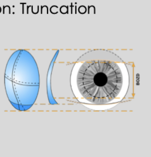 <ul><li><p>Truncation aligned with LOWER lid margin can create some CL stabilisation </p></li></ul><p></p><ul><li><p>Truncation can cause some discomfort </p></li></ul><p></p><ul><li><p>Truncation not always successful </p></li></ul><p></p><ul><li><p>more px visits can be required </p></li></ul><p></p><ul><li><p>not used now </p></li></ul><p></p>