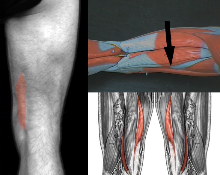 <p>What muscle is this?</p>