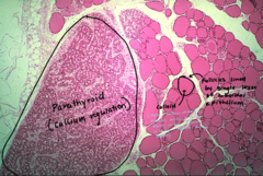 <p>1. follicles</p><p>2. colloid</p><p>3. parathyroid</p>