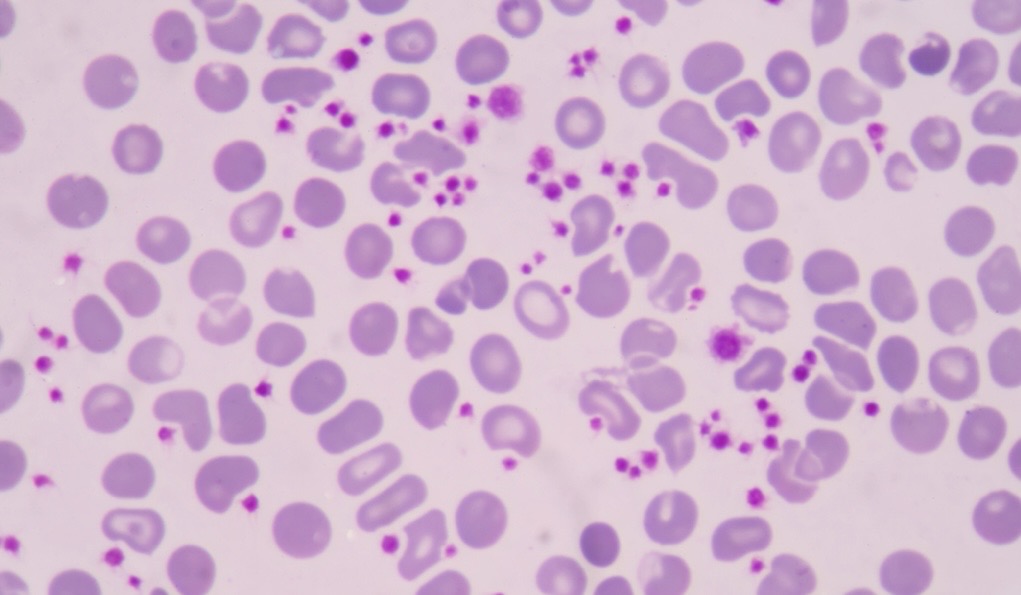 <p>Describe these platelets</p>
