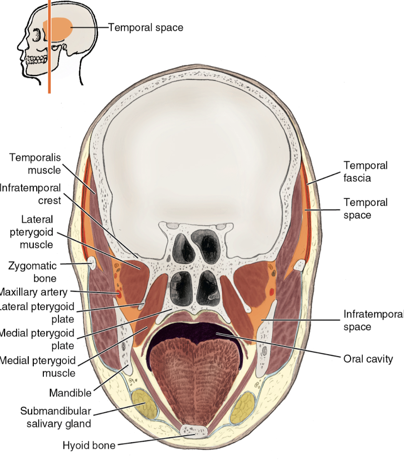 <p>What is this photo an example of?</p>