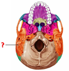 <p>Identify this structure.</p>