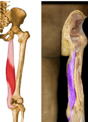 <p>ischial tuberosity</p>