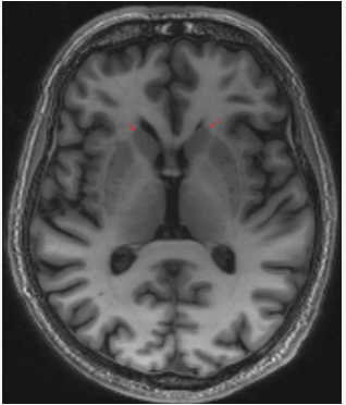 <p>Name the part of the brain</p>