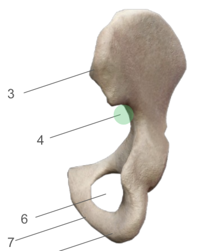 term image