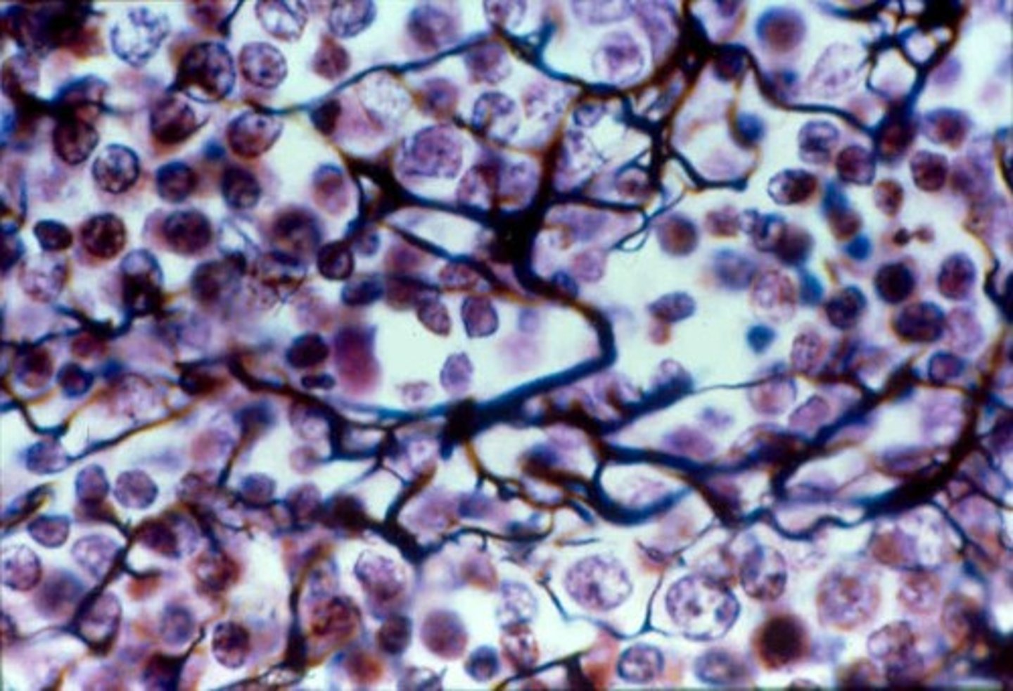 <p>Reticular Connective Tissue</p>