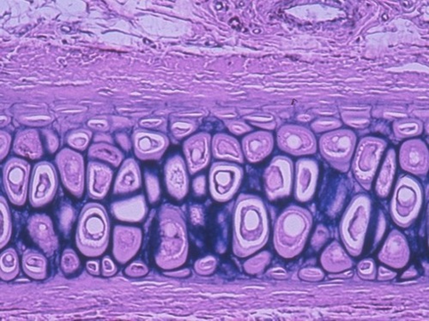 <p>Elastic Cartilage</p>