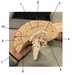 <p>What structure is 6</p>