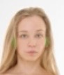 <p>Otic</p>