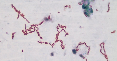 <p>Bacteria Species:</p><p>Endospore +/ - : </p><p></p>