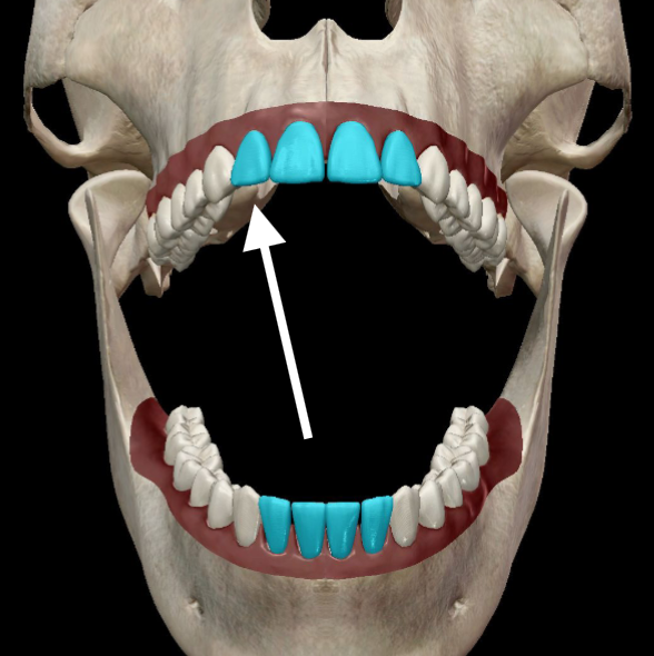 <p>What tooth is this in correct Tooth Notation form?</p>