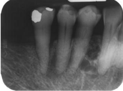 <p>Provide 1 provisional diagnosis</p>