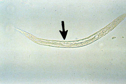 <p>Identify the parasite and its characteristics</p>