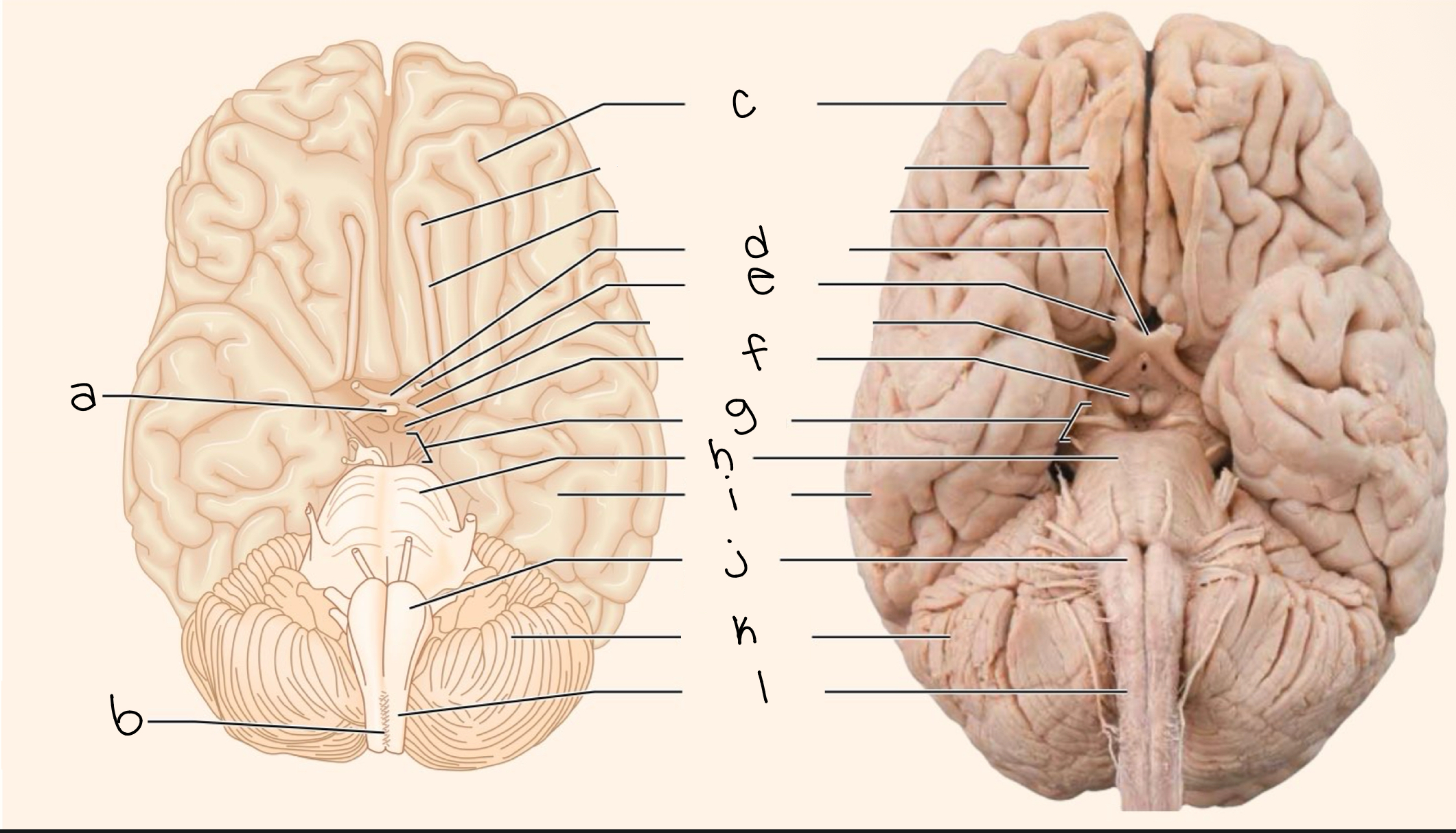 <p>label picture</p>