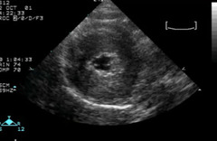 <p>Normal or abnormal?</p>