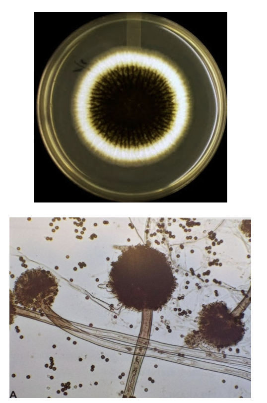 <p>-Dark-brown/black colonies</p><p>-Vesicle has two rows of phialides covering the whole surface</p><p>-Black conidia</p>