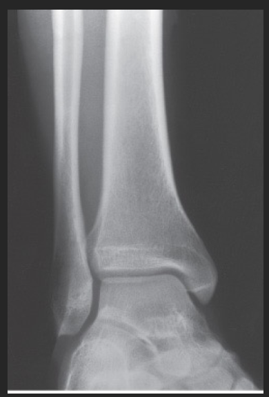 <p>State the degree and type of rotation used.</p>