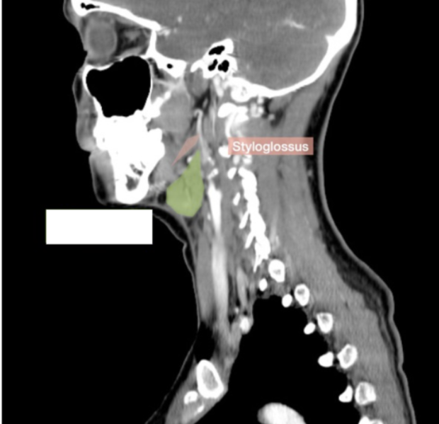 <p>What gland is this? </p>
