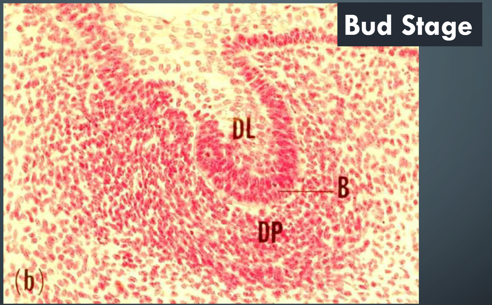 <ul><li><p>The Bud Stage</p></li><li><p>In this stage bud stage of tooth development as the dental laminae fold inward over the developing maxilla and mandible.</p></li></ul><p></p>