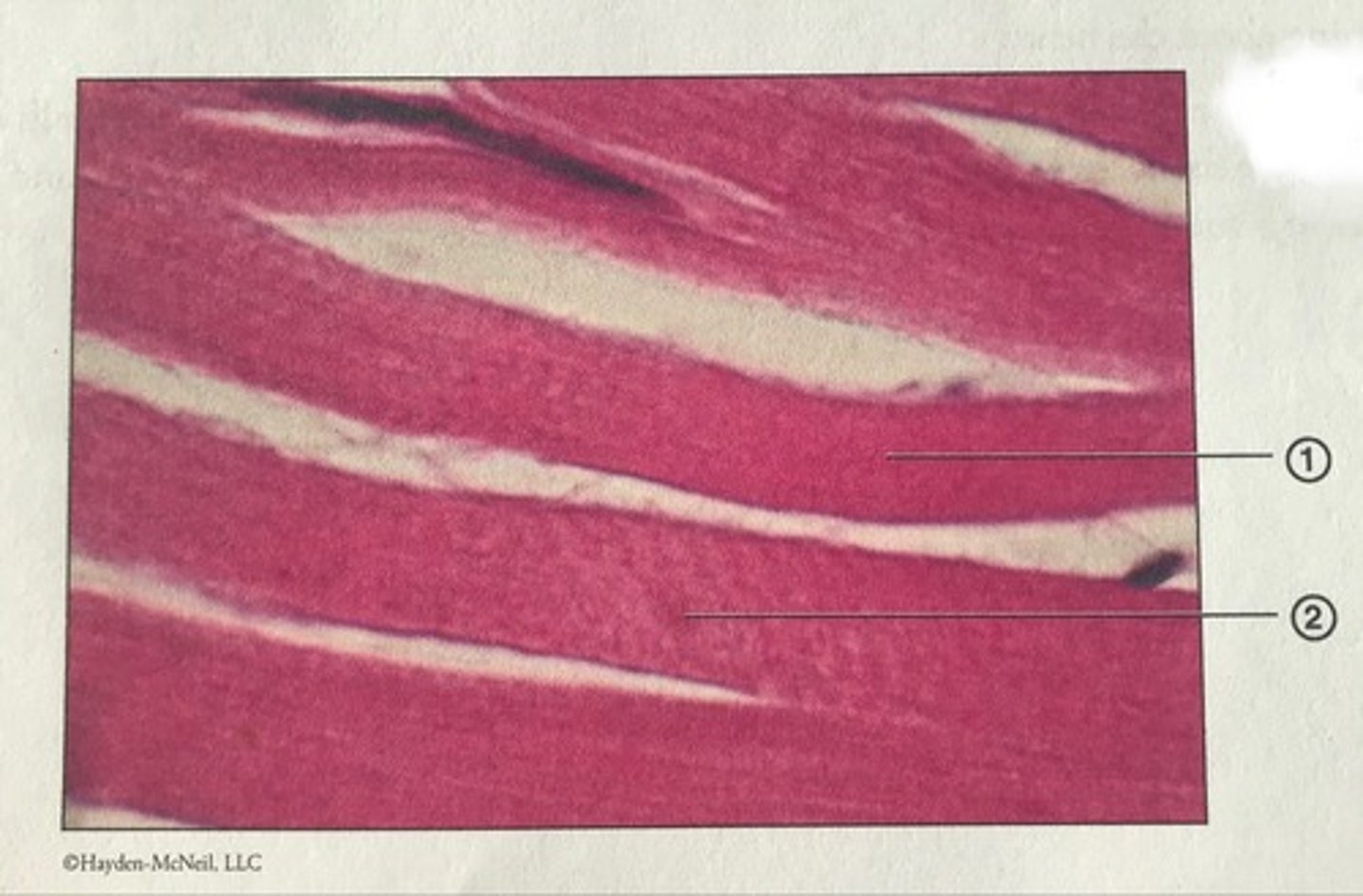<p>Which type of muscle tissue is this? What is #2?</p>