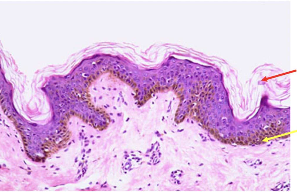 <p><span>Identify the dark/brownish cell at the tip of the yellow arrow</span></p>
