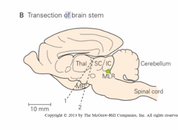 <p>brain stem is completely transected at level of midbrain</p><p>disconnects rostral brain centres (especially cerebral cortex) from spinal centres (where locomotion pattern generated)</p><p>for investigation of cerebellum &amp; brain stem in control of locomotion</p>