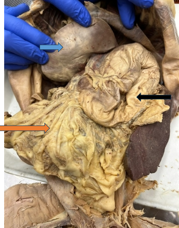 <p>What are the arrows pointing to?</p>