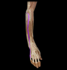 <p>slender muscle on the ulnar side of the extensor digitorum, originates on the lateral epicondyle of the humerus, extends proximal phalanx of little finger</p>