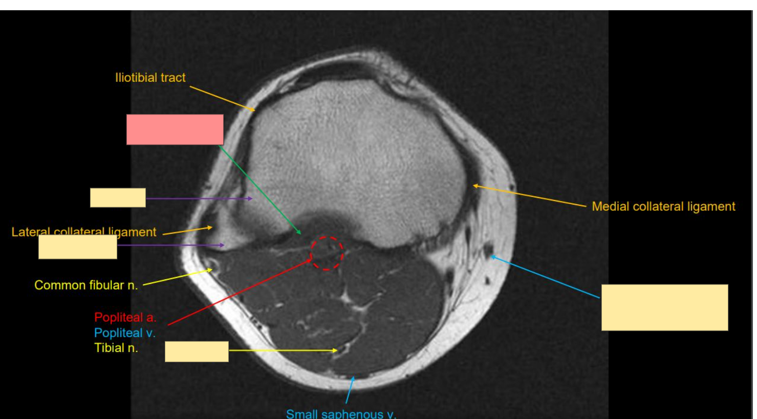 <p>Identify the structure</p>