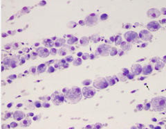 <p>This is from a dog joint with chronic forelimb lameness</p><p>1. what kinds of cells do you see?</p><p>2. inflammatory or noninflammatory?</p>