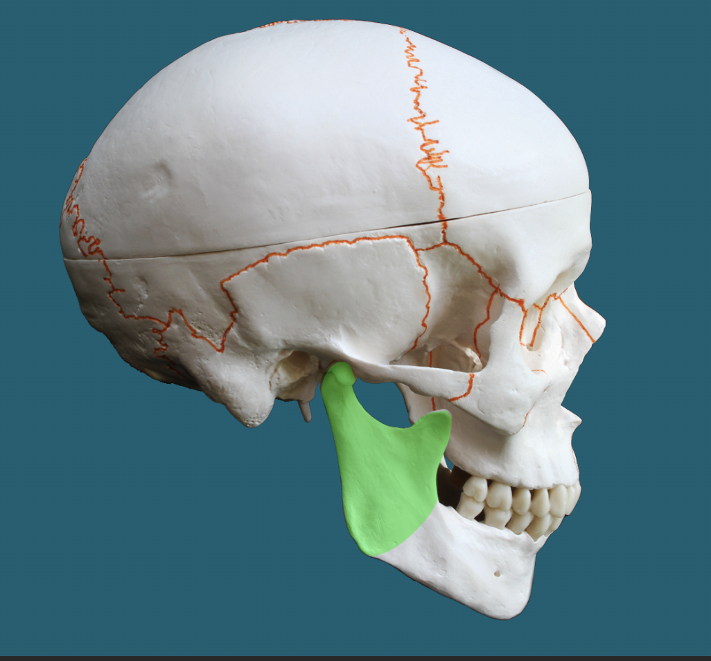 term image