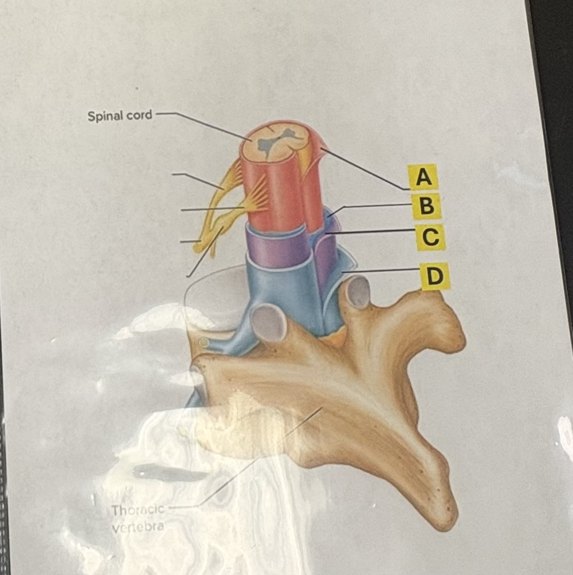 <p>C. Identify this covering associated with the spinal cord</p>