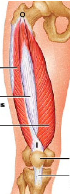 <p>vastus intermedius</p>