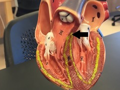 <p>Identify the structure.</p>