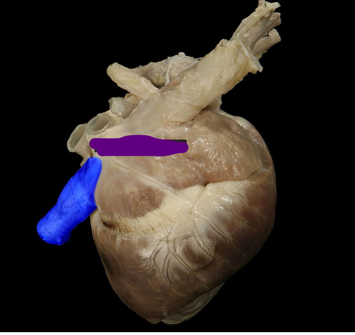 <p>Name the structure </p>