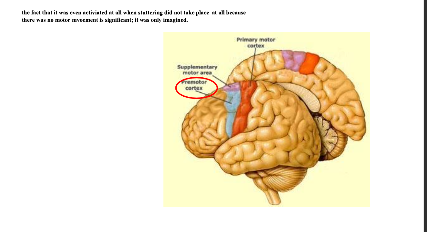 <p>During solo and choral reading, AWS were asked to imagine they were stuttering. </p><p></p><ul><li><p><strong>Imagined stuttering produced activation similar to actual moments of stuttering. </strong></p></li><li><p><strong>During overt stuttering the superior lateral premotor cortex (SLPrM) was strongly activated but it was only weakly activated when stuttering was imagined. </strong>the fact that it was even activated at all when stuttering did not take place/there was no motor movement is significant. </p></li><li><p><strong>in general, most areas of the brain activated during overt stutterig were also activated during imagined stuttering </strong></p></li></ul><p></p><p></p><p>food for thought: what if you asked your client to imagine if they were fluent?if client only looked at their fluent speech (aka one study editing videos of them and only keeping fluent part) the results showed that the client became more fluent, so maybe it is about visualizing fluency, it may help client, who knows needs more research but worth a try as a clinician </p>