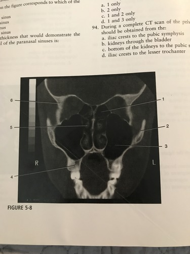 <p>Which number on the figure corresponds to the zygomatic bone? </p><p>A) 3</p><p>B) 1</p><p>C) 2</p><p>D) 6</p>
